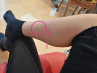 ふくらはぎの一箇所が擦ると痛い 押すと痛いのですが 病気か何かでしょう Yahoo 知恵袋