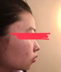 250枚 横顔の評価をお願いします これは私なのですが 100点満点 Yahoo 知恵袋