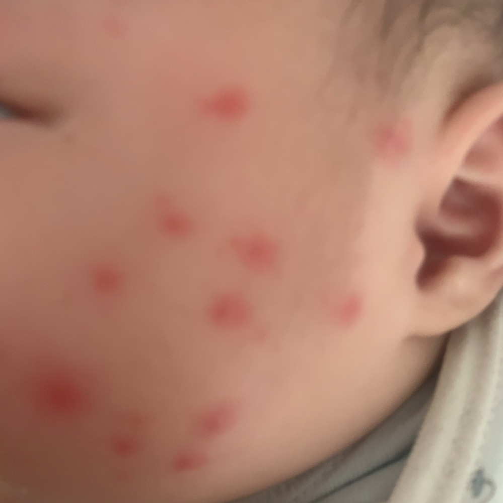 赤ちゃんほっぺのキスで虫歯菌は移りますか ０歳児の初ママです Yahoo 知恵袋