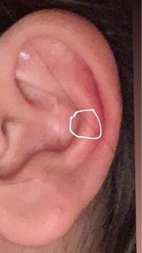 ここにピアスって開けれますか スナッグではなく 耳の後 Yahoo 知恵袋