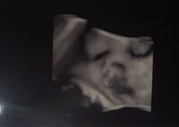 妊娠32週エコー写真について教えてください 今日検診に行ったのです Yahoo 知恵袋