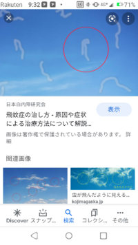 予定帝王切開で入院してて たまに画像のように透明な虫が動いて Yahoo 知恵袋