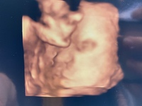 はじめまして 妊娠10ヶ月 臨月の妊婦です 本日検診だ Yahoo 知恵袋