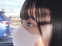 これって出目か奥目どっちですか 奥側の目を見るとひっ Yahoo 知恵袋