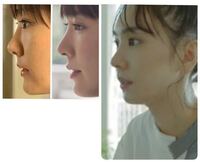 新垣結衣 ガッキー って最近また整形しました Yahoo 知恵袋