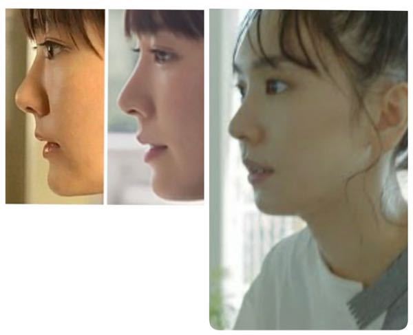 新垣結衣   鼻 新垣結衣(ガッキー)って最近また整形しました？ - Yahoo!知恵袋