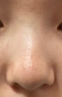 鼻筋が全くなくてコンプレックスです メイクで鼻筋を書こ Yahoo 知恵袋