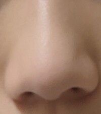 鼻がコンプレックスですこれはどのような種類に属すのでしょうか Yahoo 知恵袋