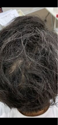 ハードスプレーで付いた白い粉が髪から取れません お湯でふやかしても取 Yahoo 知恵袋