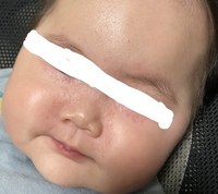 赤ちゃん 目 の 周り 赤い こ する
