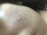写真注意です 日焼け止めを塗ったまま寝て朝風呂 Yahoo 知恵袋