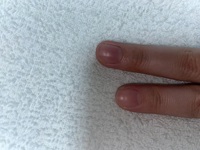 自爪がとても短いのですがｽｶﾙﾌﾟできますか 爪の白い部分は１ 程しか伸び Yahoo 知恵袋