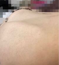 22歳の女です 肋骨の出っ張りがコンプレックスで仰向け Yahoo 知恵袋