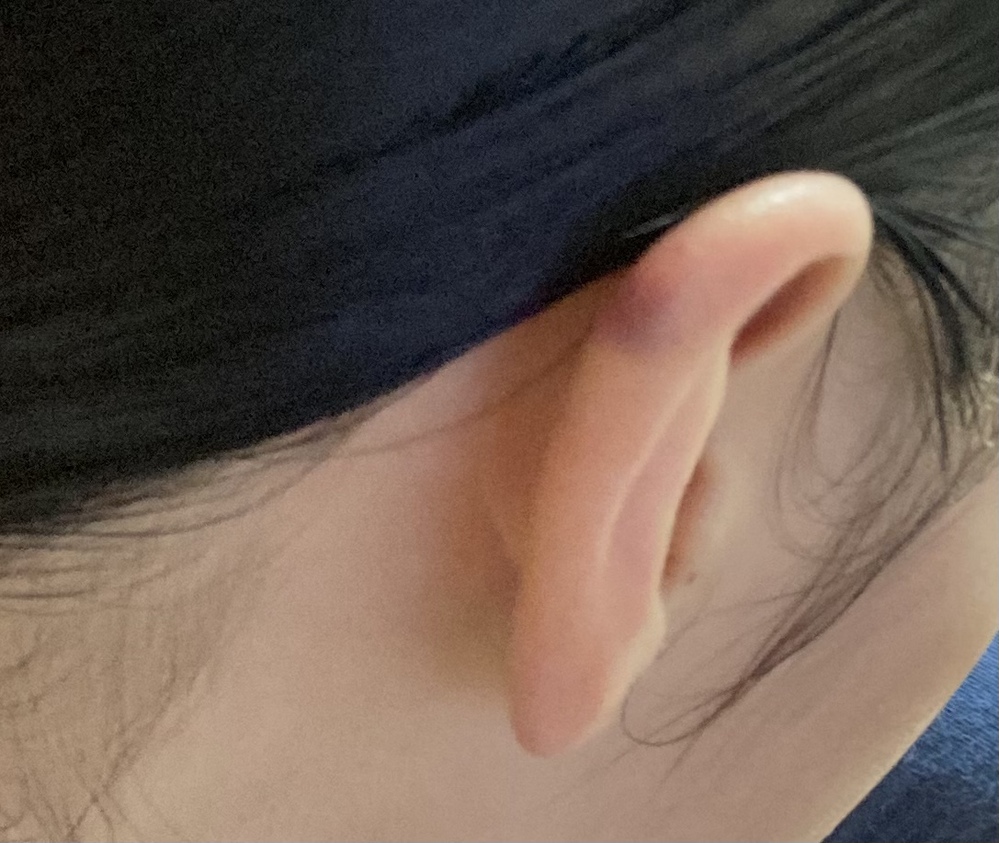 耳の病気 解決済みの質問 Yahoo 知恵袋