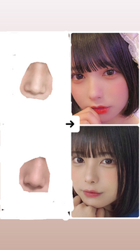 鼻を整形したいのですが どこをどうすればいいのかが分かりません Yahoo 知恵袋