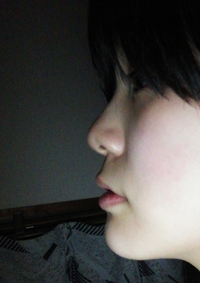 写真ありです 顎しゃくれてますかね コンプレックスで悩んでます Yahoo 知恵袋