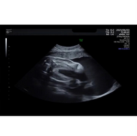 エコー写真の性別についてです 28週のエコー写真です 女の子 Yahoo 知恵袋