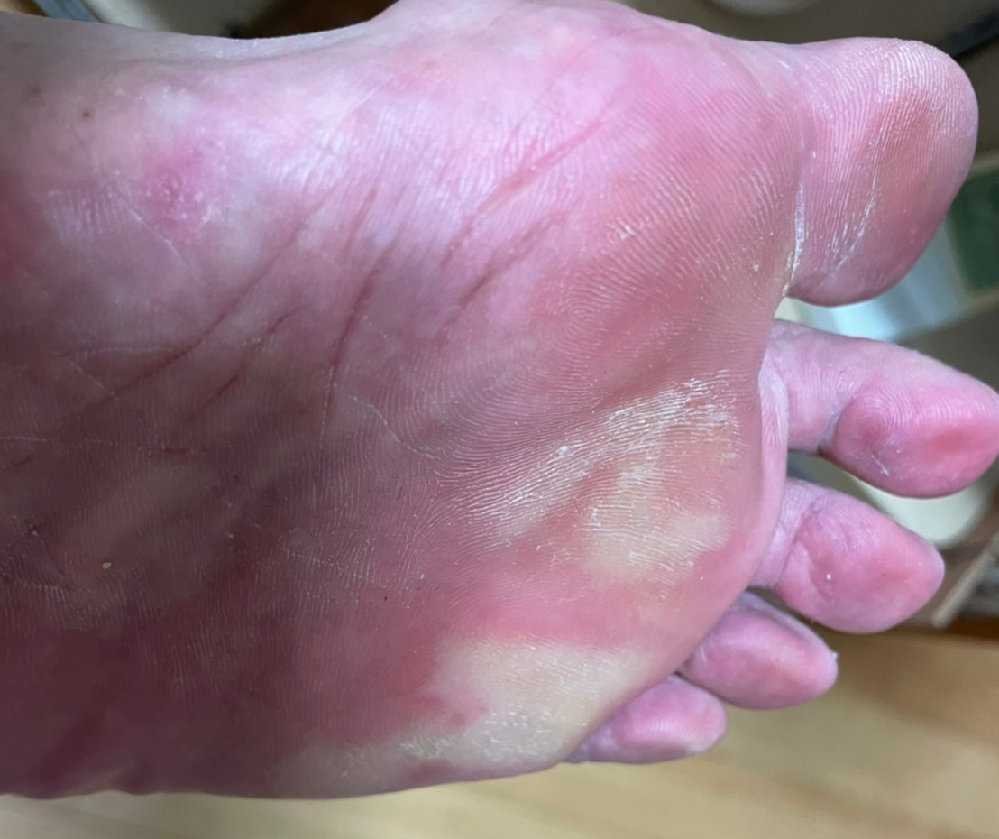 ウォーキング 解決済みの質問 Yahoo 知恵袋