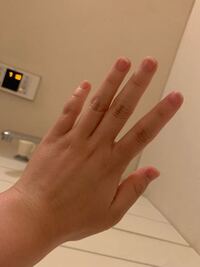 指太いですよね 骨格だから痩せても変わらないでしょうか Yahoo 知恵袋