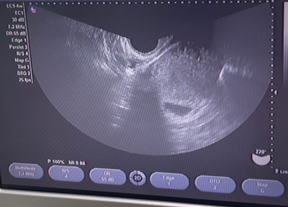 27歳繋留流産経験してます 現在妊娠6w0dで胎嚢mmまで成 Yahoo 知恵袋