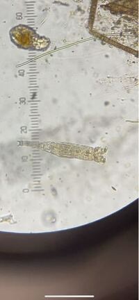 扶養130万円 社会保険の扶養 収入130万円 個人事業主 の壁 とは 全国健康保険協会 協会けんぽ に問い合わせてみた ごま基地