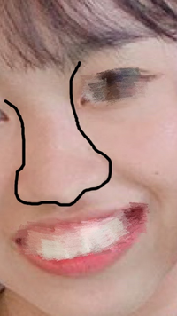 鼻の形が物凄くコンプレックスです 写真ドアップで分かりづらかったので線 Yahoo 知恵袋