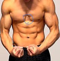 筋トレについて。 胸筋に画像のような凹みがあるのですが、原因はやはり遺伝的なものですか？  遺伝によって胸筋の形が悪い場合は、筋肉を肥大させてもある程度しか改善しないのでしょうか？  ちなみに画像は質問者本人ではありません。