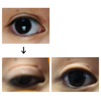 アイテープの使い方について質問です 貼った直後は二重っぽくなっています Yahoo 知恵袋