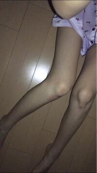 この写真の足を見て気持ち悪いと思いますか 周りから拒食症と言わ Yahoo 知恵袋