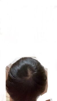 21歳男です このつむじはハゲてますか ここ半年ほど忙 Yahoo 知恵袋