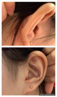ヘリックスを耳の上らへんに開けたいと思っているのですが なかなか可愛い Yahoo 知恵袋