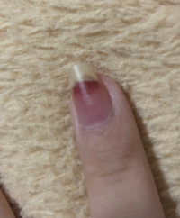 ジェルネイル セルフ で仕上がりが気に入らなすぎてやり直したいです 翌日に一 Yahoo 知恵袋