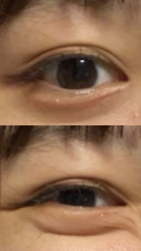 お見苦しい写真を添付してしまいすみません 普段の目には涙袋が全くと言っ Yahoo 知恵袋