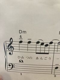 至急 吹奏楽の音符の上についてる記号 この記号が全くわかりません 出 Yahoo 知恵袋