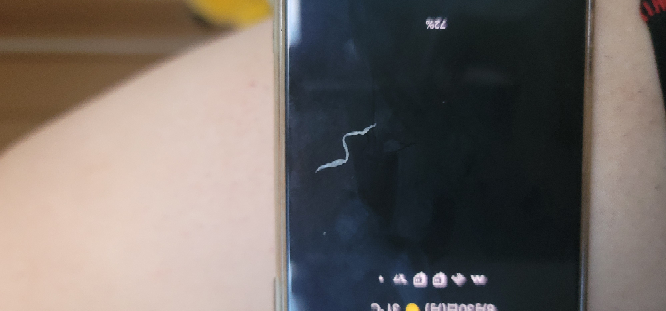 たまに目から白い糸が出たんで取ったのですが これは何ですか Yahoo 知恵袋