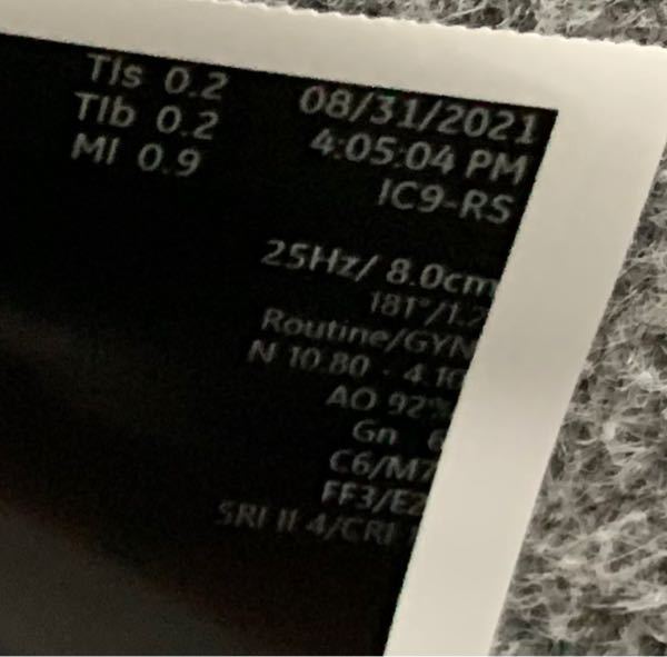 妊娠5週と5日目です 本日胎嚢を確認できました このエ Yahoo 知恵袋