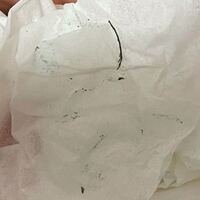 シャーペンの先を回して外れるところにこのような緑のカビみたいなのが付く Yahoo 知恵袋