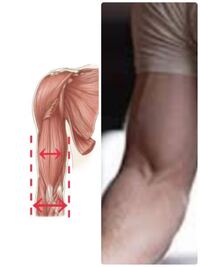 手のひらを正面にして見た時 二の腕の筋肉が前腕より細く見えま Yahoo 知恵袋