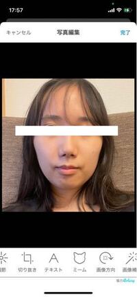 整形についてです お見苦しい写真ですみません 輪郭が凸凹で団子鼻 Yahoo 知恵袋