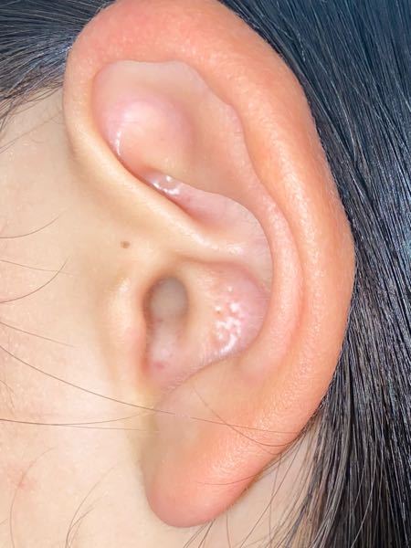 耳の病気 投票受付中の質問 Yahoo 知恵袋