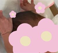 モロー反射っていつまでですか 生後3ヶ月 103日 の子なんですけど新生 Yahoo 知恵袋