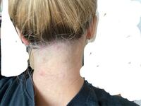 襟足を間違えて剃りすぎてしまいました とても後悔してい Yahoo 知恵袋