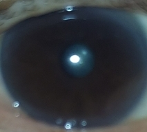 目の病気 回答受付中の質問 Yahoo 知恵袋