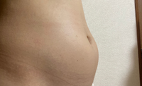 便秘です 1週間もでていません 病院にいって薬は飲んでいます 最近お腹 Yahoo 知恵袋