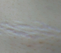 これは 何かの病気なのでしょうか それとも 一時的なものでし Yahoo 知恵袋