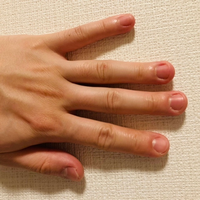 爪の面積って大きくできるのでしょうか 今は治りましたが 幼少期に爪噛み Yahoo 知恵袋