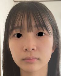 閲覧注意外カメです 人中が長いのと 中顔面長いのと 顔面が左右非対称過 Yahoo 知恵袋