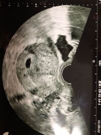 妊娠5週目だと思います 先週11日に行った際胎嚢も見え Yahoo 知恵袋