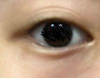 瞼が三重です。瞼の皮膚が多いせいで二重にしたらかなり気持ち悪くなります。どうにかする方法はありませんかね？生まれつきです、、、画像が荒くて見にくいですが実物はもう少し線が濃いです 
