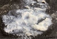 閲覧注意 画像です 今日 おりものがいつもと違いました 何か病気 Yahoo 知恵袋